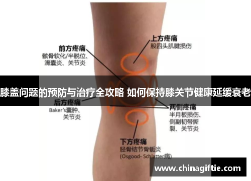 膝盖问题的预防与治疗全攻略 如何保持膝关节健康延缓衰老